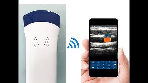 Portable doppler scan ultrasound MSLPU54