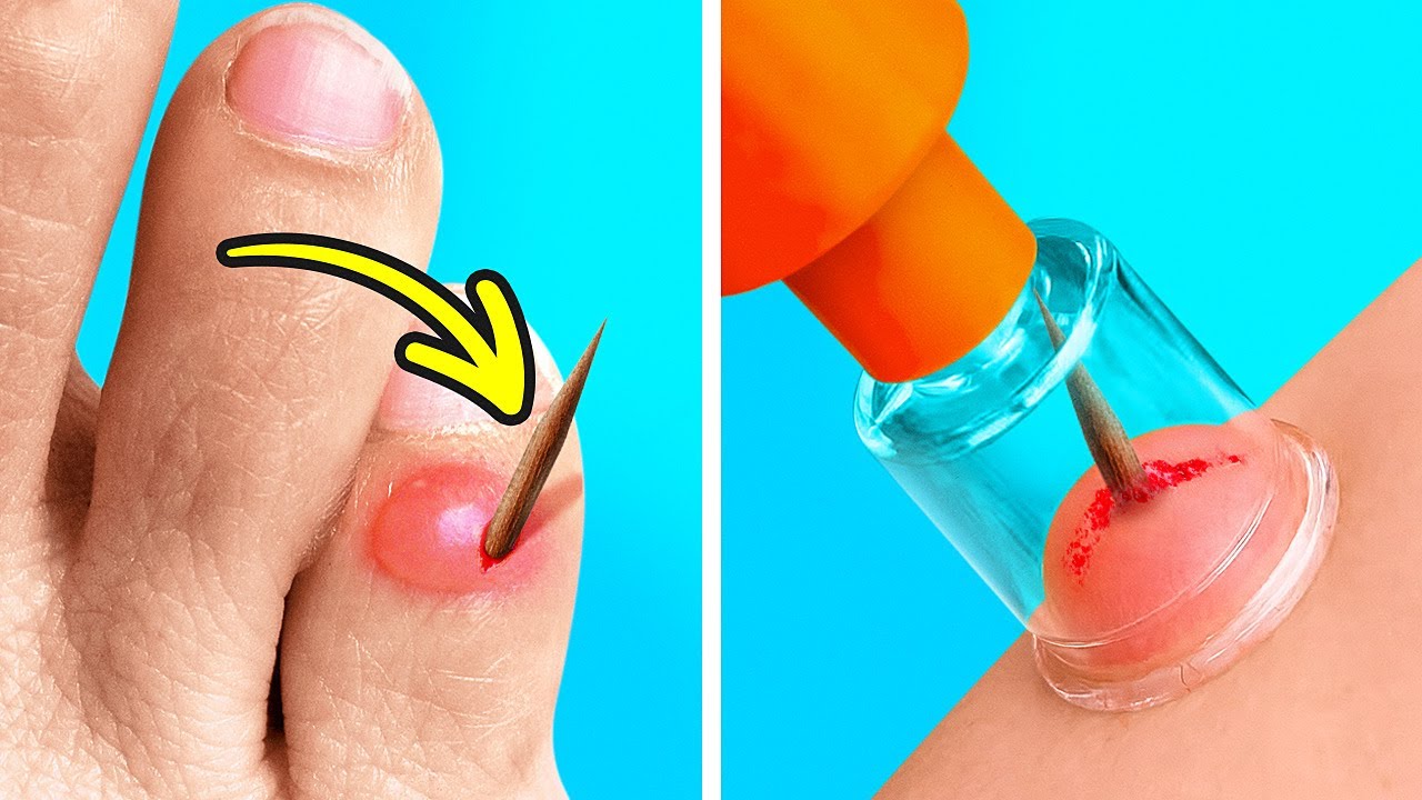 OUCH! Emergency Hacks, First Aid Tips and Gadgets for Clumsy People