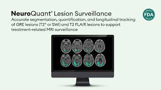 Cortechs.ai's Innovative Solutions for Healthcare Imaging