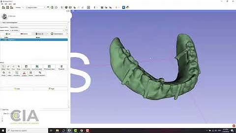 Superimposition of the denture on CBCT (arabic): 02 Using 3D slicer with Bluesky