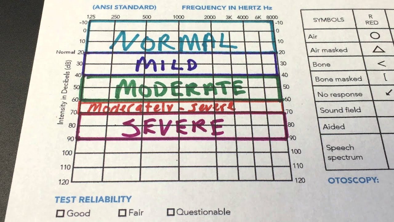 Audiogram Chart