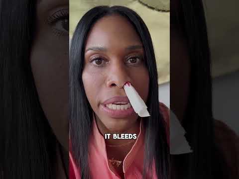 What is Epistaxis?