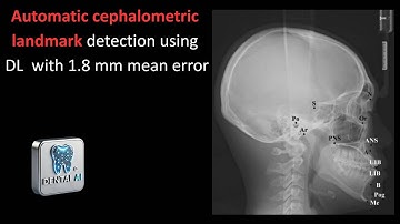 Automatic cephalometric landmark detection using deep learning