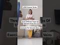 Yoga For Varicose Veins | Yoga For Calves | Tadasana Walk | Tadasana Exercises | For Leg Strength |