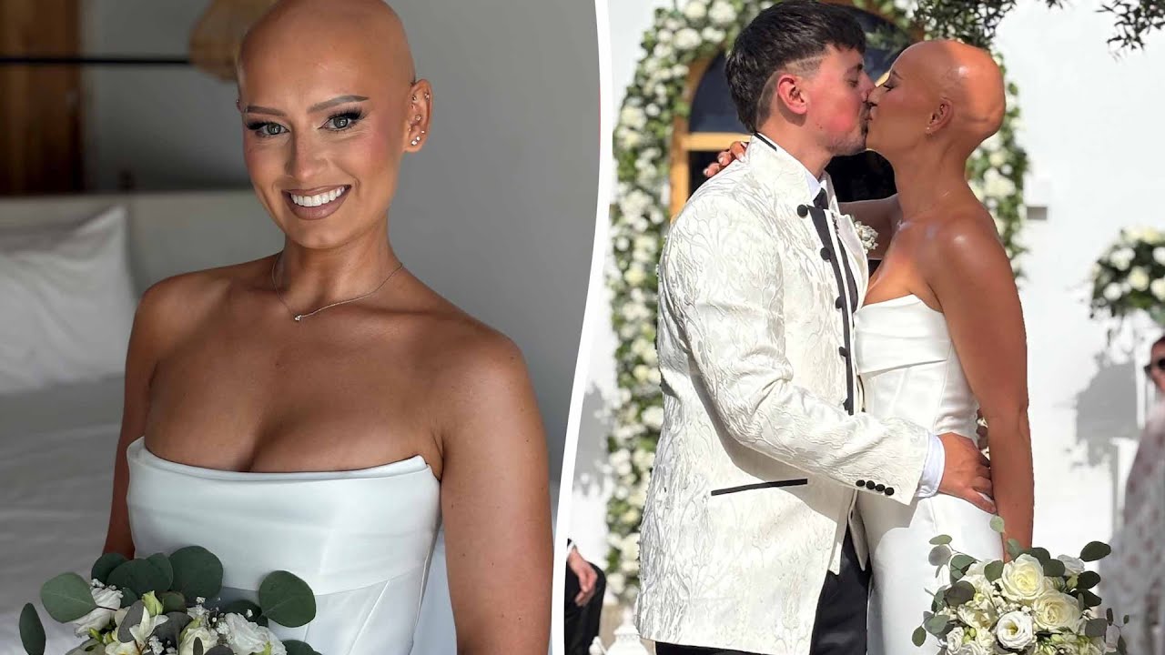 Bride embraces natural look and walks down aisle without her wig | SWNS