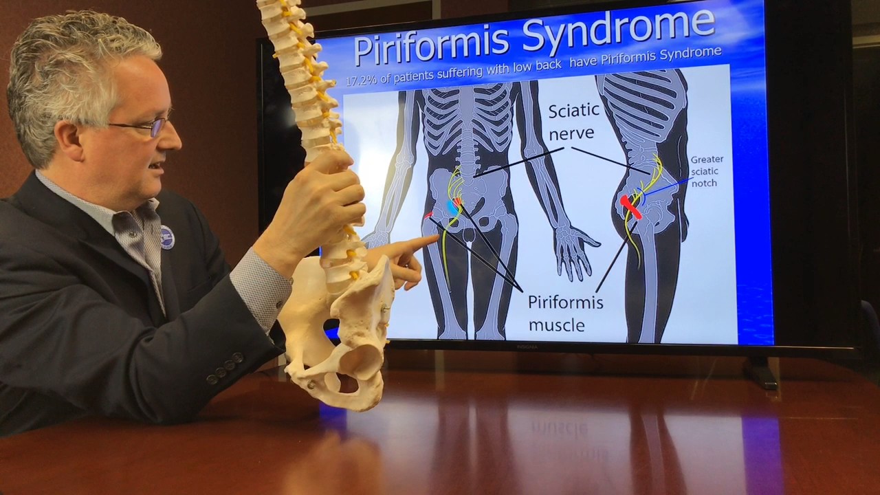 The Number One Sciatica Stretch - Piriformis Stretch sciatica treatment medication