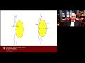 Lecture: Angle Closure Glaucoma: Primary and Secondary