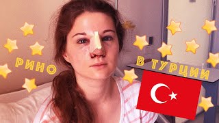 История одного большого носа. Моя ринопластика в Стамбуле. Часть #1