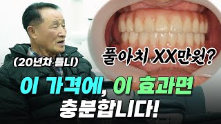 풀아치 임플란트 가격 ***만원!  1년 후에도 이만큼 효과면 왜 안하세요?