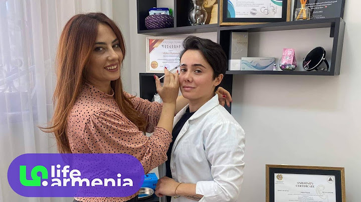 LIVE. Կանացի կնճիռների հարթեցում, կամ բոտոքսի լավ ու վատ կողմերը՝ բժիշկ Մելոյանի հետ