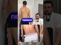 Причіна перекосу тазу