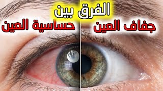كيف تعرف هل أنت مصاب بحساسية العين أو جفاف العين؟