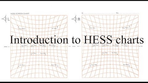 Introduction to HESS Chart