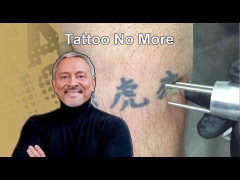 Video: Tatoeage-littekens: Kan Ik Ongewenste Tatoeage-littekens Behandelen Of Verwijderen?