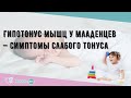 Гипотонус мышц у младенцев — симптомы слабого тонуса