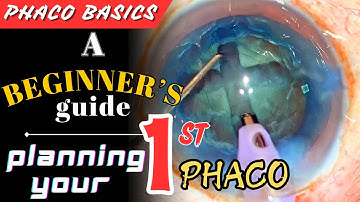 Planning your first Phaco.? Divide & Conquer  for the absolute Beginner: A step by step Guide.