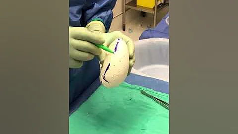 Dr. Kevin Nini Expander Wrap with FlexHD Pliable