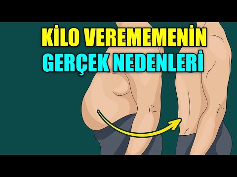 KİLO VEREMEMENİN GERÇEK NEDENLERİ