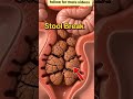 Constipation #ConstipationRelief #IBS  #Gut #Digestive #BloatingRelief #HealthyDigestion #IBS