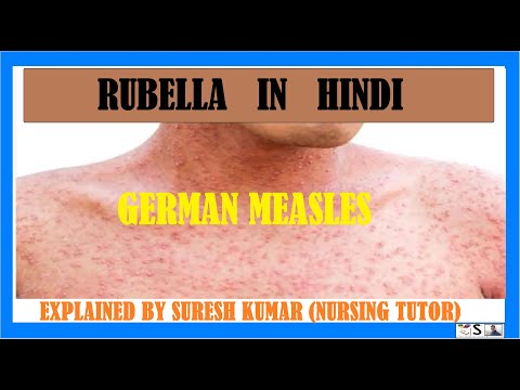 रूबेला क्या है? | RUBELLA IN HINDI | जर्मन खसरा | पूरी जानकारी