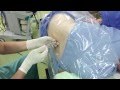 今週の硬膜外麻酔6例 2 epidural anesthesia by Dr.EpiCal