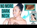 HOW TO GET RID OF DARK NECK FAST & NATURALLY | LIGHTENING & BRIGHTENING Home Remedies