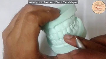 Tooth Numbering System - FDI Tooth Numbering System