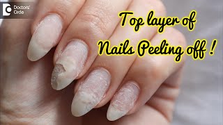 Nail flaking and peeling off. Causes & Homeopathic Treatment - Dr. Sanjay Panicker |Doctors' Circle