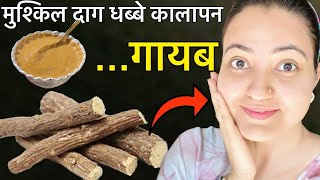 त्वचा की मुश्किल समस्या जैसे झाइयाँ HYPER PIGMENTATION, DARK SPOTS का 100% इलाज़ सिर्फ 1 हफ्ते में💕 screenshot 5