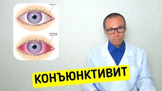 Аллергический Конъюнктивит - от А до Я