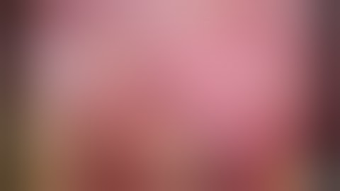 LAPAROSCOPIC LEFT HEPATECTOMY