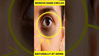 Remove Dark Circles Naturally #priyamalikchannel #darkcircles #diy #skincare
