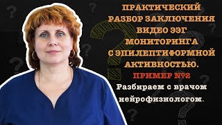 ПРИМЕР №2 ПРАКТИЧЕСКИЙ РАЗБОР ЗАКЛЮЧЕНИЯ ВИДЕО ЭЭГ МОНИТОРИНГА С ЭПИЛЕПТИФОРМНОЙ АКТИВНОСТЬЮ