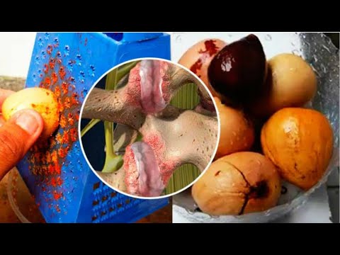 medicina casera para hemorroides ESTE REMEDIO SE PREPARA EN MINUTOS, QUITA EL DOLOR DE HUESOS Y ARTICULACIONES