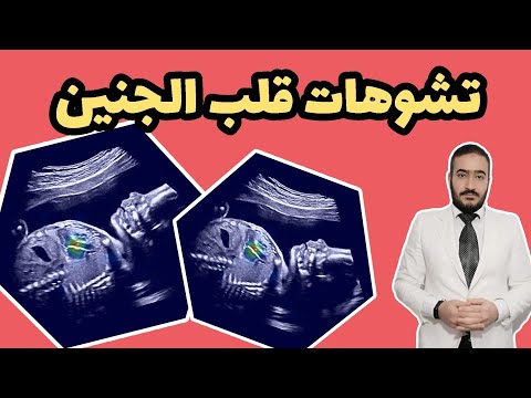 ما أسباب تشوهات قلب الجنين وكيف تحافظ الحامل على قلب الجنين من العوامل البيئية