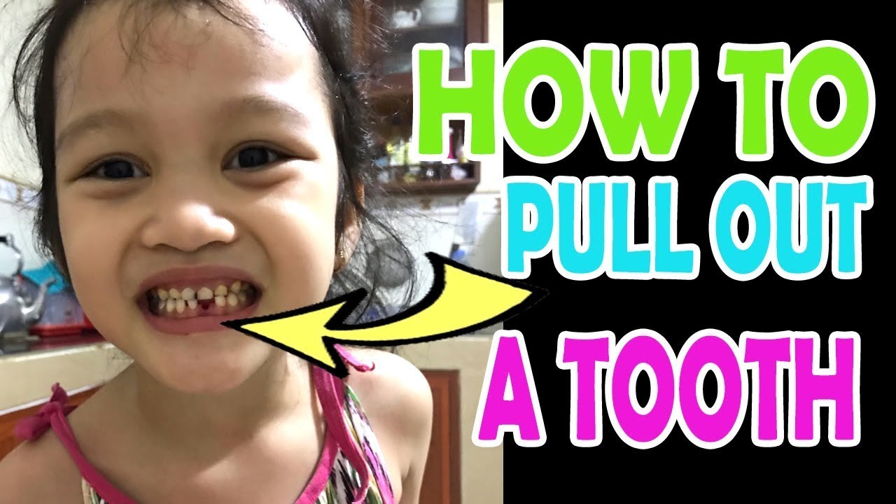 HOW TO PULL OUT A TOOTH YouTube