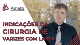 Quando fazer cirurgia de varizes com laser! saúde para suas pernas!