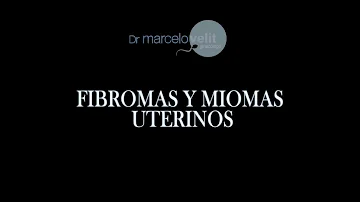 Como tirar um fibroma?