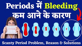 पीरियड्स खुलकर क्यों नहीं आते | Less Bleeding During Periods | Periods me bleeding ho to kya kare