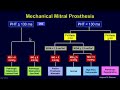 Echocardiographic Evaluation of Mitral Valve Prostheses