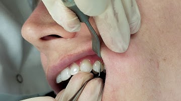 Barnhart 5/6 Instrumentation