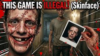 This Game is Illegal! (Skinface Gameplay)