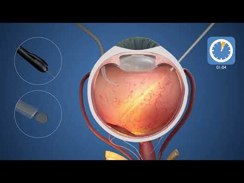 Prima animation