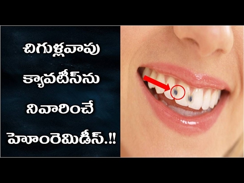 చిగుళ్ల-వాపు,-క్యావిటీలను-నివారించే-హోంమేడ్-|-cavites-nivarinche-home-remides?