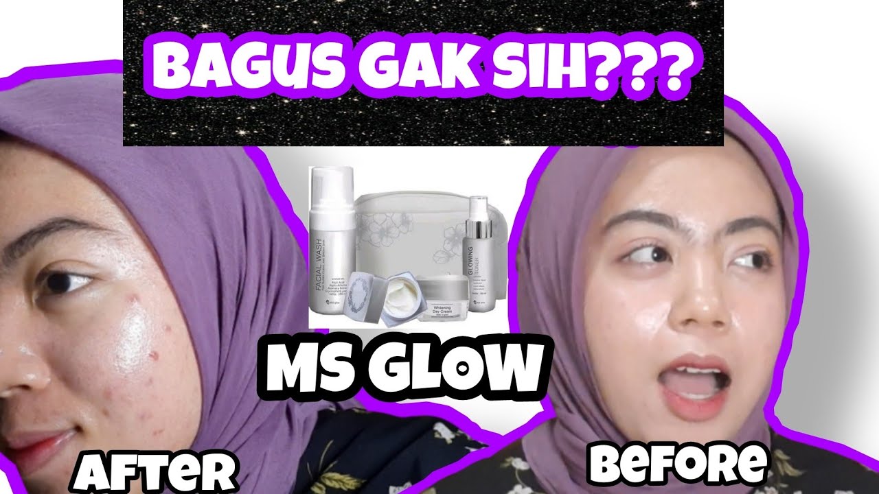 REVIEW MS GLOW PART 2 | PENYEBAB JADI JERAWATAN? - YouTube