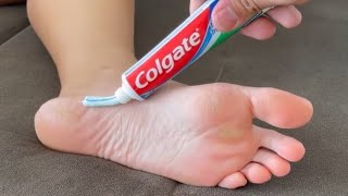 Put TOOTHPASTE on Your FEET - You Won't Believe the Results the Next Day! - USEFUL HOME TIPS Information