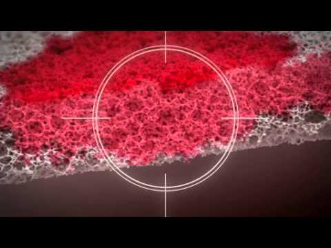 Video: Von Lungenepithelzellen Stammendes IL-25 Reguliert Die LPS-induzierte Exosomenfreisetzung Aus Makrophagen Negativ