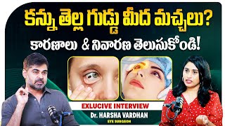 Best Treatments For Eye Spots In Telugu Causes Spots On The Eye White Smartvision Eye Hospital