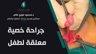 عملية خصية معلقة لطفل | دكتور محمود فوزي غالي استشاري ومدرس جراحات الذكورة والعقم