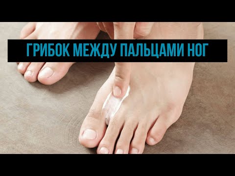 Грибок между пальцами ног: симптомы лечение и профилактика болезни
